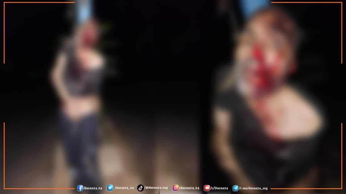 ابو طارق الصبيحي مربوطا إلى أحد الأعمدة في بلدة المزيريب