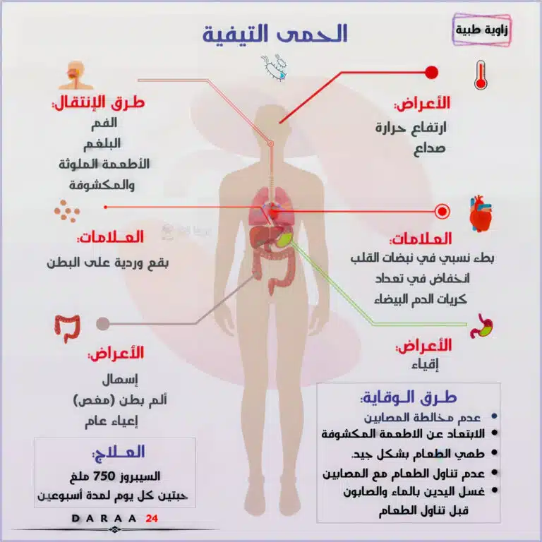 الحمى التيفية