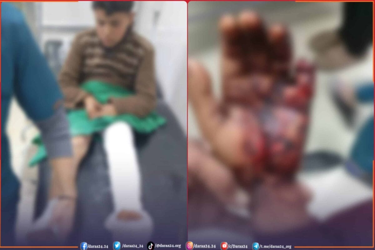 إصابات الطفلين من بلدة بصر الحرير في الريف الشرقي من محافظة درعا