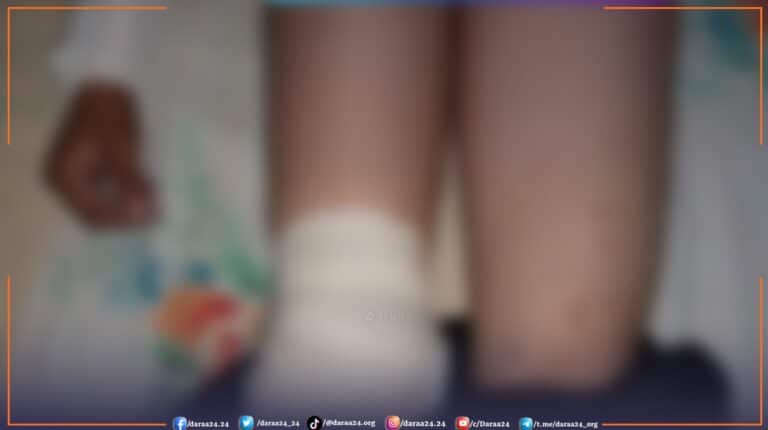 إصابة طفلين في الصنمين نتيجة العبث بذخائر عسكرية