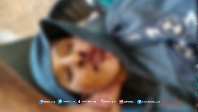 انفجار لغم من مخلفات الحرب في ريف درعا الشرقي 4 انفجار لغم يودي بحياة شاب ويصيب آخر أثناء رعي الأغنام قرب اللواء 52 شرق درعا
