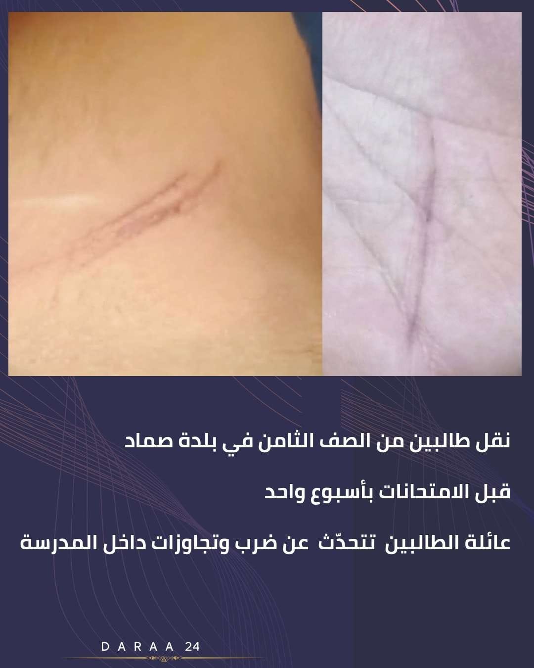 قل طالبين من الصف الثامن قبل الامتحانات… وذووهما يتحدثون عن تجاوزات داخل المدرسة