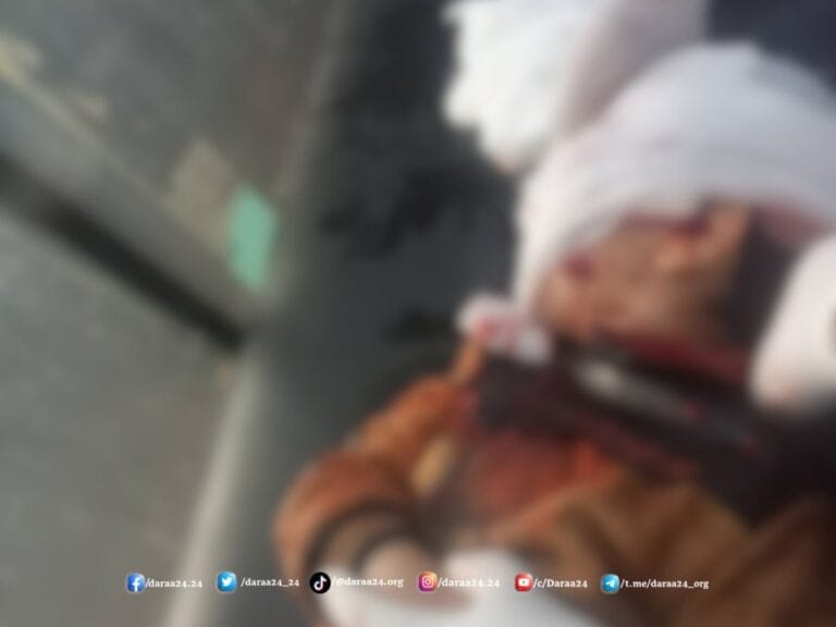 الطفل المصاب جرّاء انفجار طلق عيار 23 من مخلفات الحرب